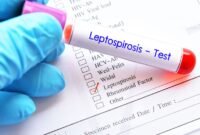 Dinas Kesehatan Tulungagung mengimbau masyarakat meningkatkan kewaspadaan terhadap leptospirosis setelah ditemukan 11 kasus positif dan satu pasien meninggal dunia.