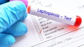 Dinas Kesehatan Tulungagung mengimbau masyarakat meningkatkan kewaspadaan terhadap leptospirosis setelah ditemukan 11 kasus positif dan satu pasien meninggal dunia.