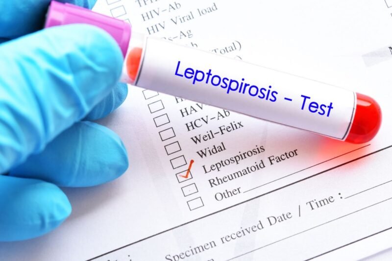 Dinas Kesehatan Tulungagung mengimbau masyarakat meningkatkan kewaspadaan terhadap leptospirosis setelah ditemukan 11 kasus positif dan satu pasien meninggal dunia.